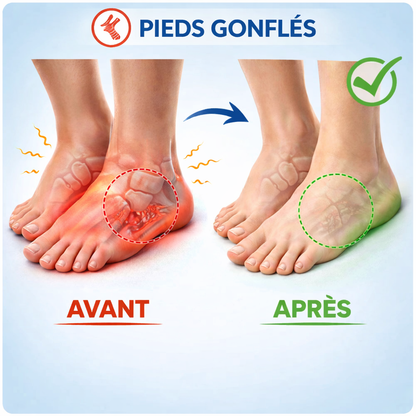Chaussettes de compression